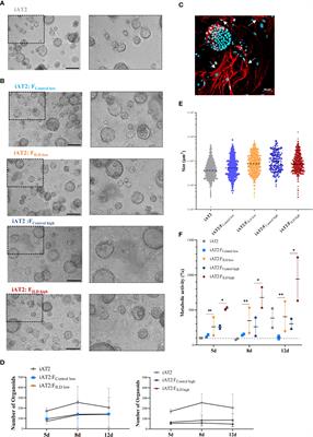 Cytokine signaling converging on IL11 in ILD fibroblasts provokes aberrant epithelial differentiation signatures